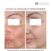 ADA TINA Biosole Oxy FPS 50 Proteção Solar com Vitaminas C e Niacinamida para Peles com Melasma