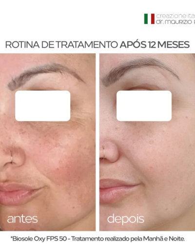 ADA TINA Biosole Oxy FPS 50 Proteção Solar com Vitaminas C e Niacinamida para Peles com Melasma