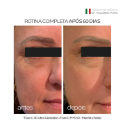 Pure C 40 Ultra Clareador 2x Mais Vitamina C Pura Renova e Clareia